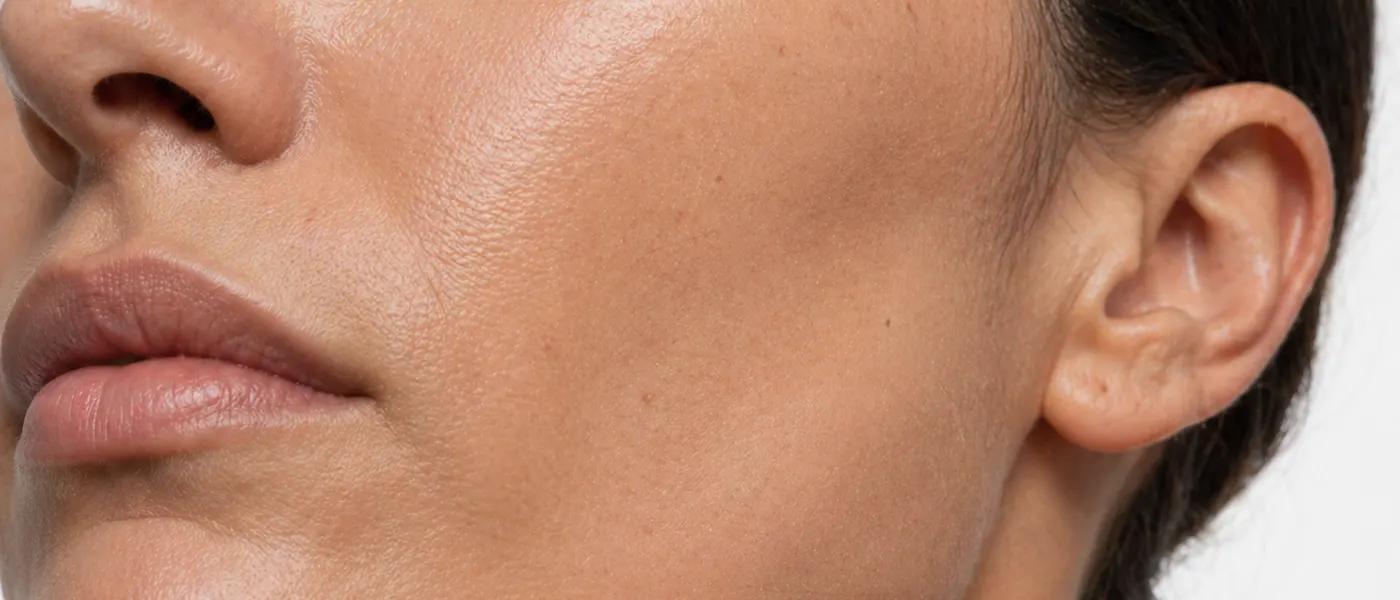 Masseter Muscle Reduction: Your Ultimate Guide to a Slimmer, V-Shaped Jawline